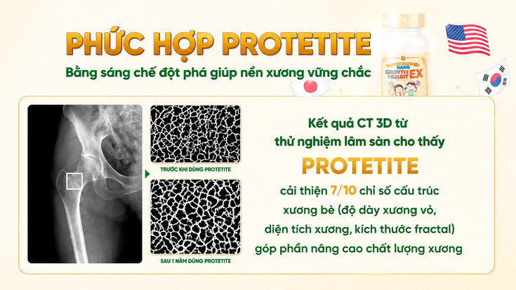 Ophuc-hop-protetite-co-trong-nano-growth-habit-ex.jpg